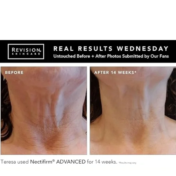 Revision Nectifirm Advanced NEW - Picture 3 of 3